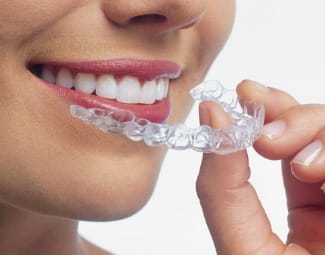 マウスピースを装着する女性